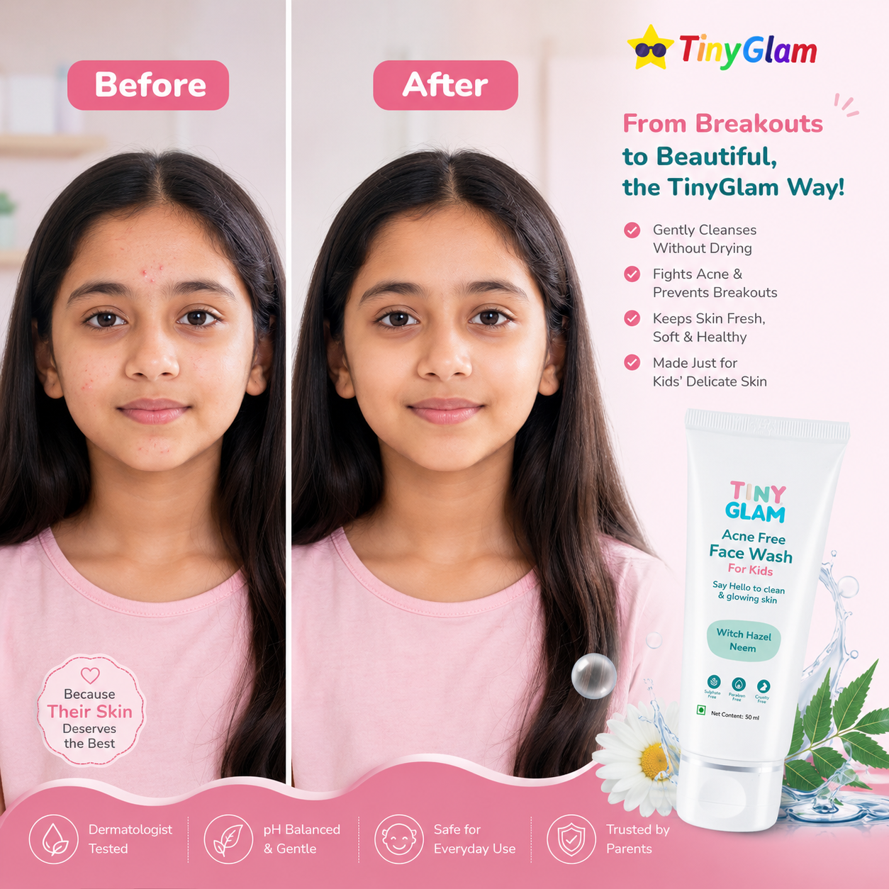 TinyGlam Acne Free Face Wash 50 ml - Gentle Acne Face Wash for Pre-Teens & Teens